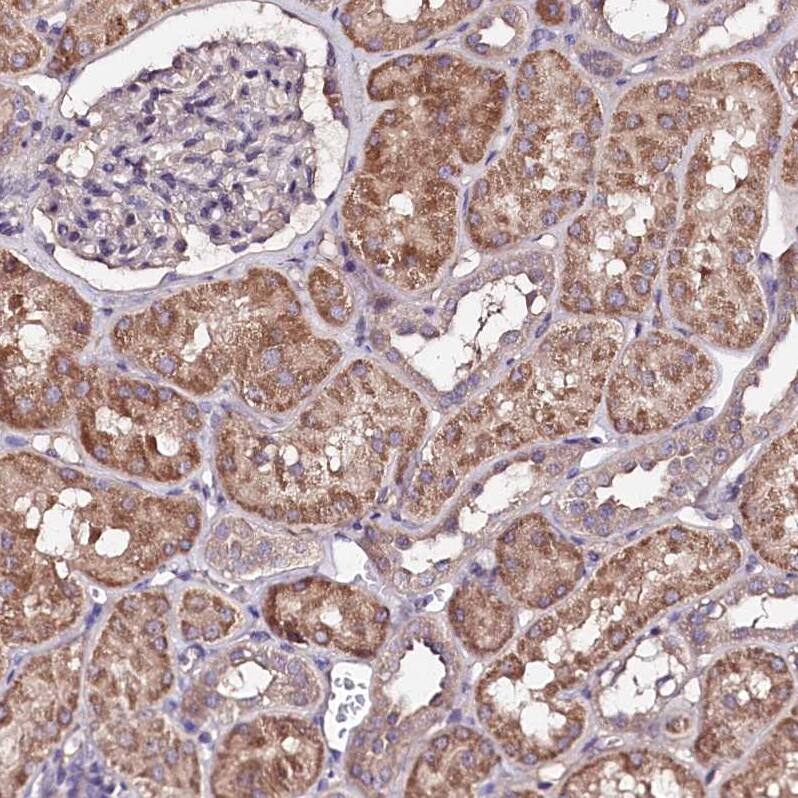 TNPO3 Antibody - BSA Free Immunohistochemistry-Paraffin: TNPO3 Antibody [NBP1-81585]