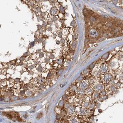 Tollip Antibody - BSA Free Immunohistochemistry-Paraffin: Tollip Antibody [NBP1-81597]
