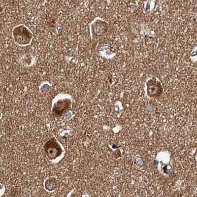 Tollip Antibody - BSA Free Immunohistochemistry-Paraffin: Tollip Antibody [NBP1-81597]