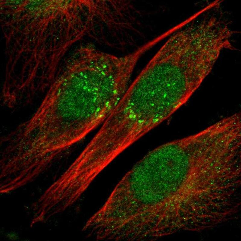 IL-18/IL-1F4 Antibody Immunocytochemistry/ Immunofluorescence: IL-18/IL-1F4 Antibody [NBP1-81607]