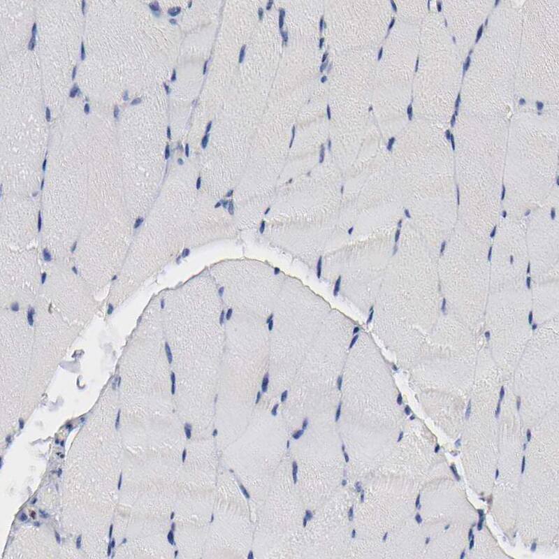 IL-18/IL-1F4 Antibody Immunohistochemistry-Paraffin: IL-18/IL-1F4 Antibody [NBP1-81607]