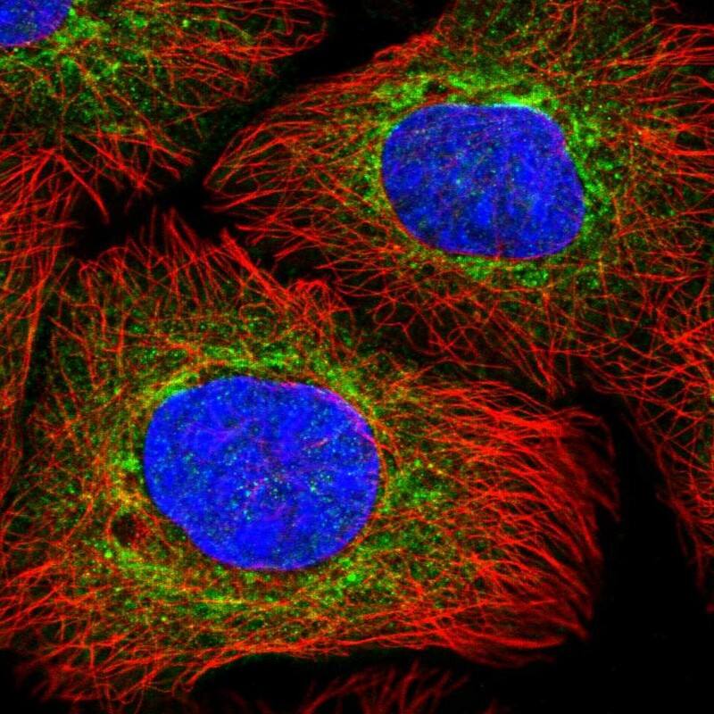 N-Acetylmannosamine Kinase/GNE Antibody - BSA Free Immunocytochemistry/ Immunofluorescence: N-Acetylmannosamine Kinase/GNE Antibody [NBP1-81621]