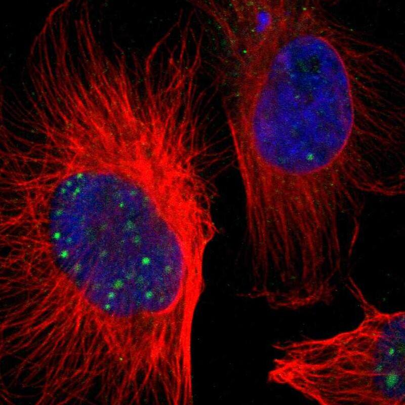 ZNF234 Antibody - BSA Free Immunocytochemistry/ Immunofluorescence: ZNF234 Antibody [NBP1-81631]