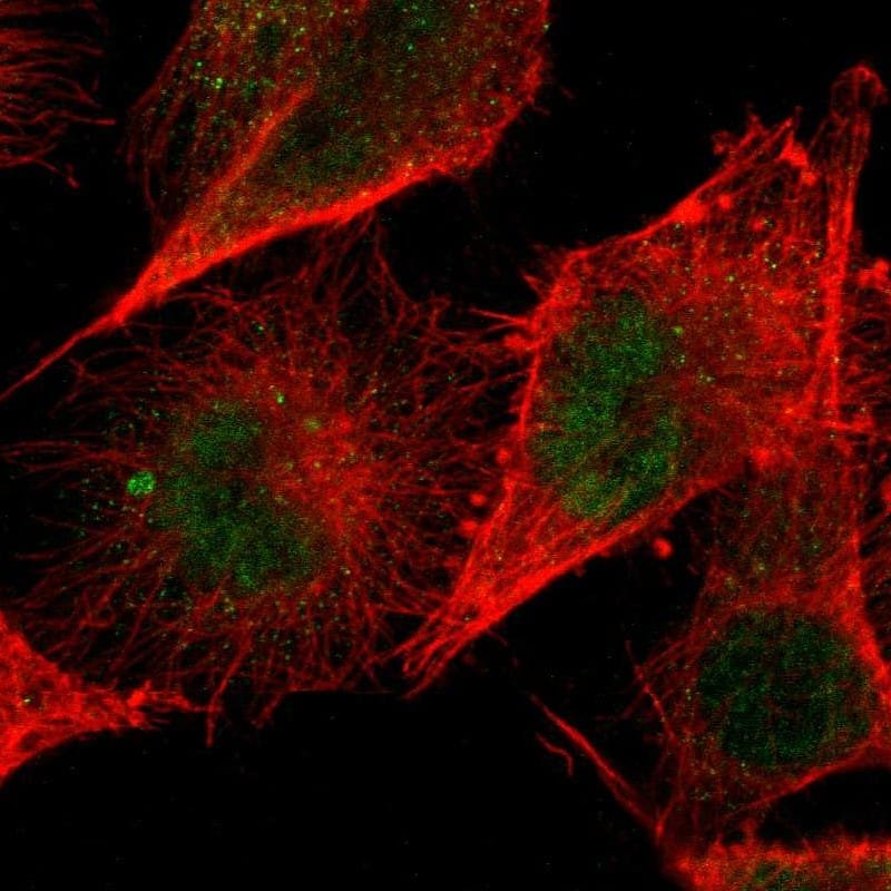 ZNF267 Antibody - BSA Free Immunocytochemistry/ Immunofluorescence: ZNF267 Antibody [NBP1-81633]