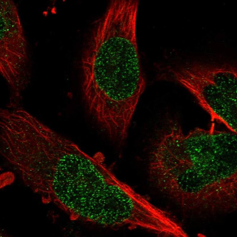 ZNF124 Antibody - BSA Free Immunocytochemistry/ Immunofluorescence: ZNF124 Antibody [NBP1-81634]