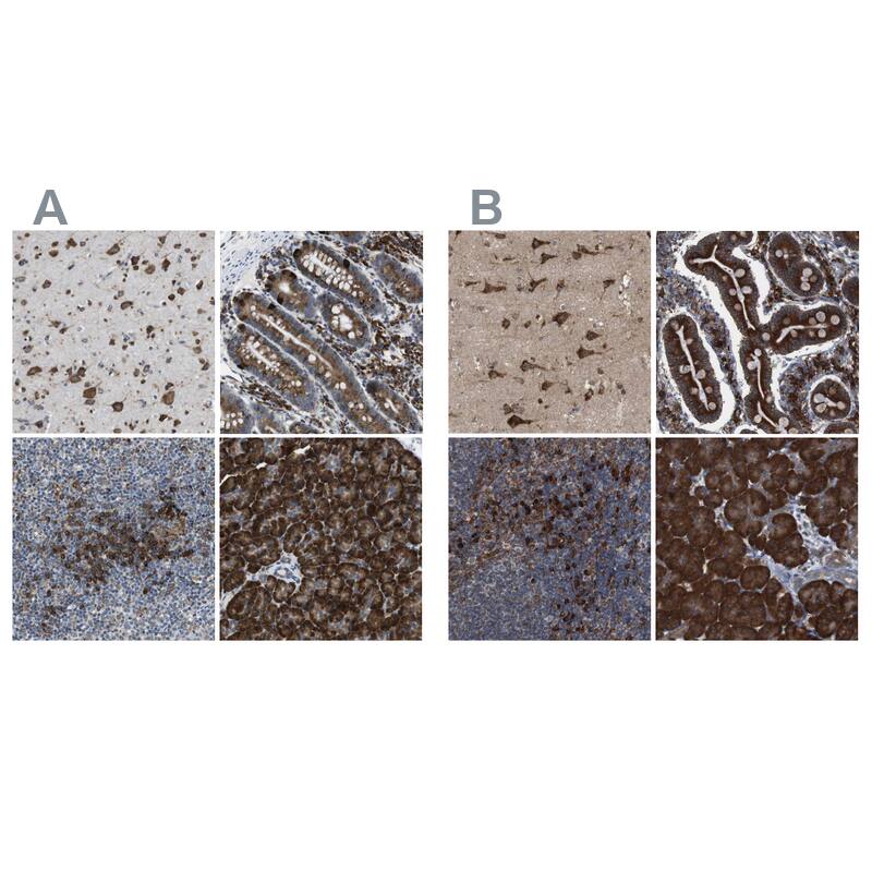 UGGT1 Antibody Immunohistochemistry-Paraffin: UGGT1 Antibody Antibody [NBP1-81651]