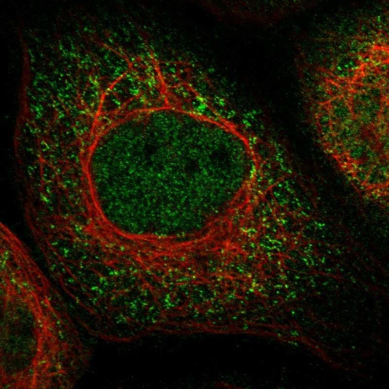 TOMM34 Antibody - BSA Free Immunocytochemistry/ Immunofluorescence: TOMM34 Antibody [NBP1-81655]