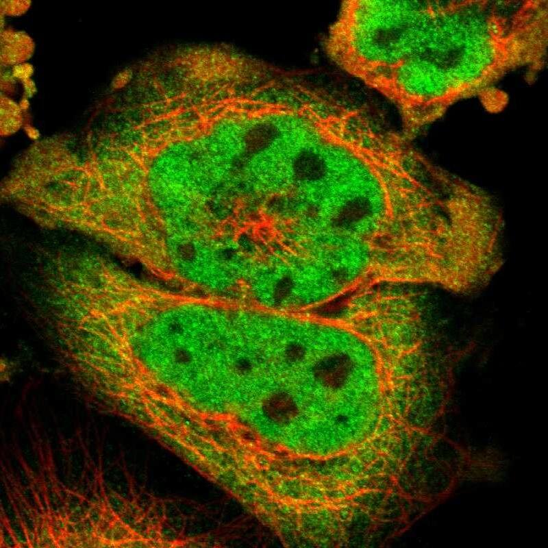 MEIS2 Antibody - BSA Free Immunocytochemistry/ Immunofluorescence: MEIS2 Antibody [NBP1-81669]