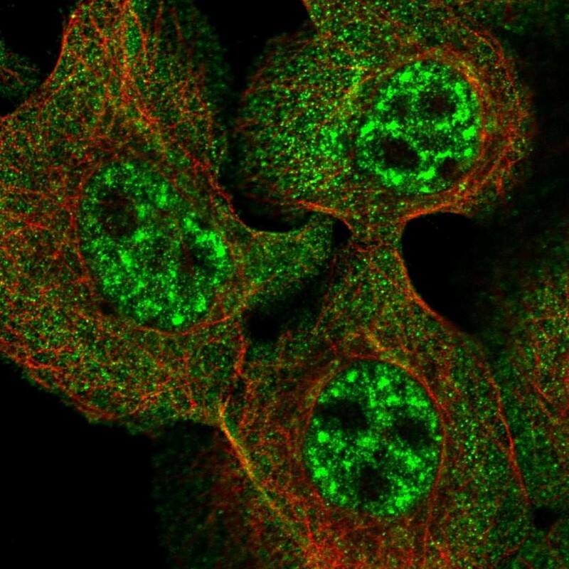 Ufc1 Antibody - BSA Free Immunocytochemistry/ Immunofluorescence: Ufc1 Antibody [NBP1-81676]