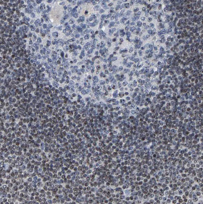 NOP58 Antibody - BSA Free Immunohistochemistry-Paraffin: NOP58 Antibody [NBP1-81680]