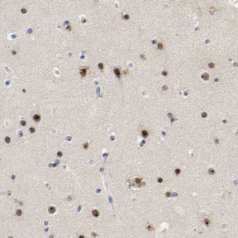 NOP58 Antibody - BSA Free Immunohistochemistry-Paraffin: NOP58 Antibody [NBP1-81680]
