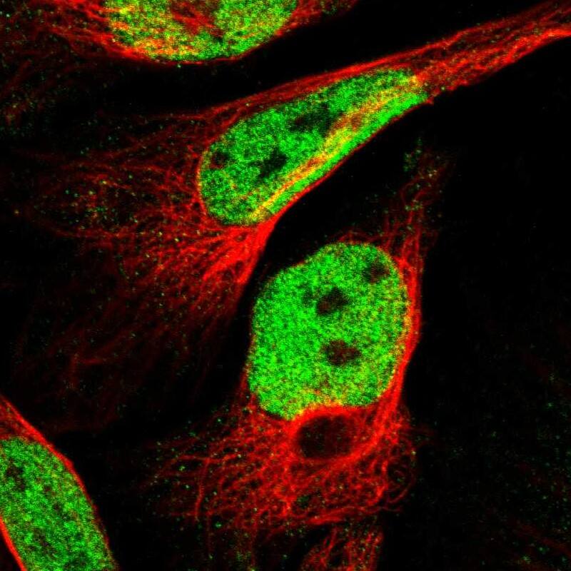 SSBIP1/SOSS-C Antibody - BSA Free Immunocytochemistry/ Immunofluorescence: SSBIP1/SOSS-C Antibody [NBP1-81682]