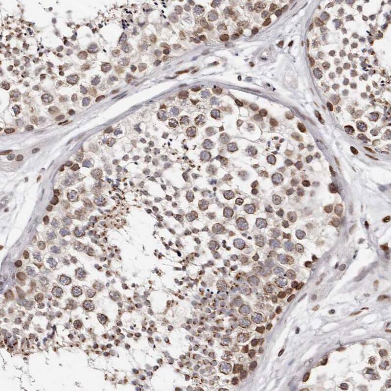 Nup153 Antibody - BSA Free Immunohistochemistry-Paraffin: Nup153 Antibody [NBP1-81723]