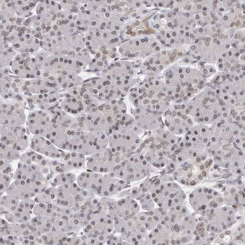 Nup153 Antibody - BSA Free Immunohistochemistry-Paraffin: Nup153 Antibody [NBP1-81723]