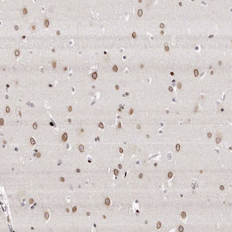 Nup153 Antibody - BSA Free Immunohistochemistry-Paraffin: Nup153 Antibody [NBP1-81723]