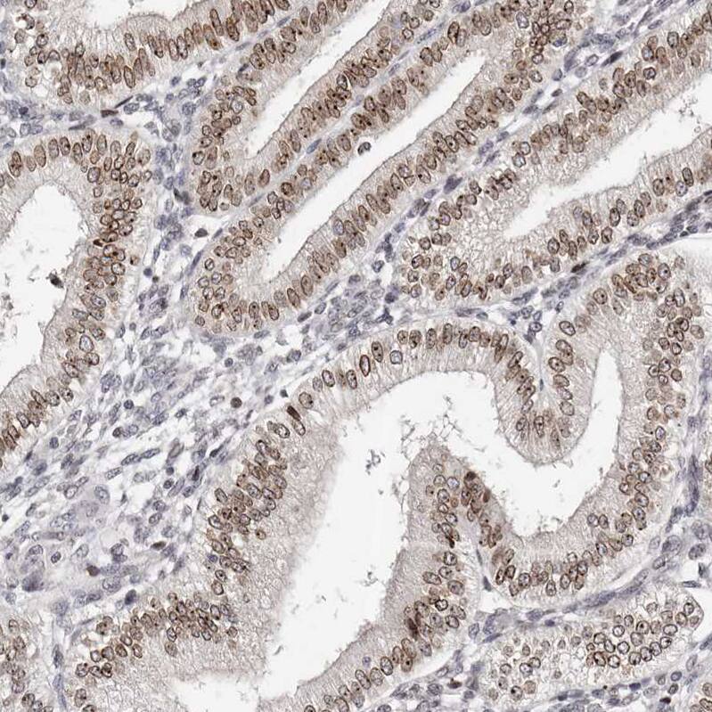 Nup153 Antibody - BSA Free Immunohistochemistry-Paraffin: Nup153 Antibody [NBP1-81723]