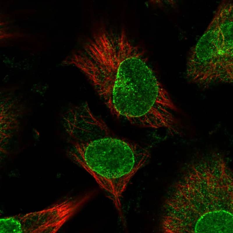 Nup153 Antibody - BSA Free Immunocytochemistry/ Immunofluorescence: Nup153 Antibody [NBP1-81725]