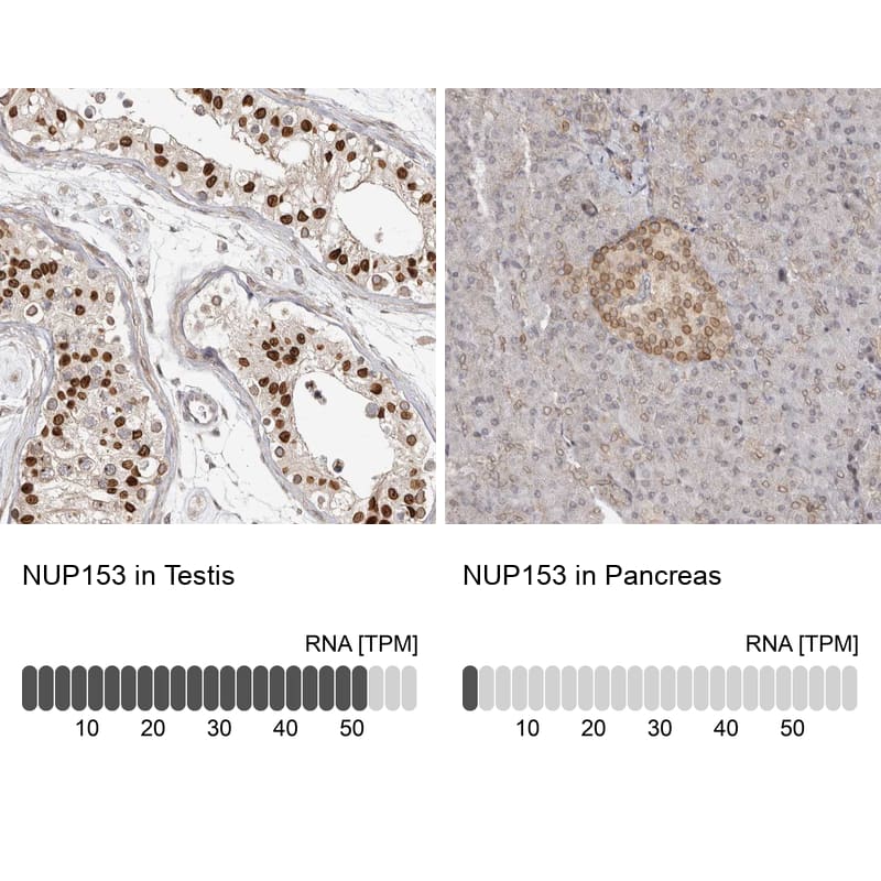 Nup153 Antibody - BSA Free Immunohistochemistry-Paraffin: Nup153 Antibody [NBP1-81725]