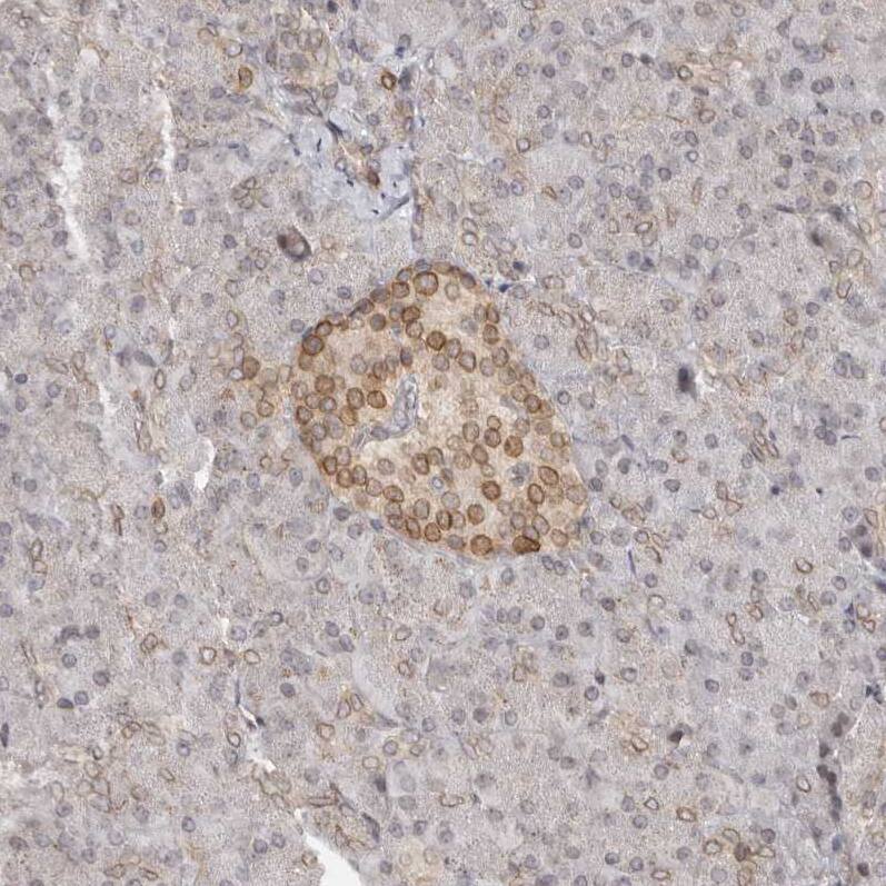 Nup153 Antibody - BSA Free Immunohistochemistry-Paraffin: Nup153 Antibody [NBP1-81725]