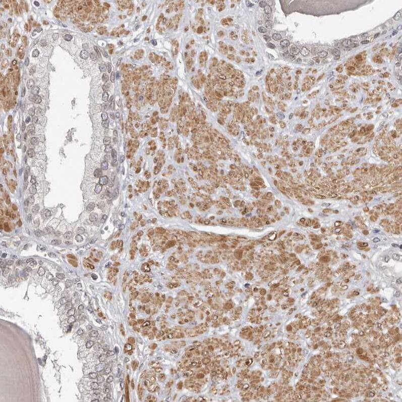 Nup153 Antibody - BSA Free Immunohistochemistry-Paraffin: Nup153 Antibody [NBP1-81725]
