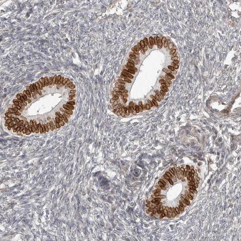 Nup153 Antibody - BSA Free Immunohistochemistry-Paraffin: Nup153 Antibody [NBP1-81725]