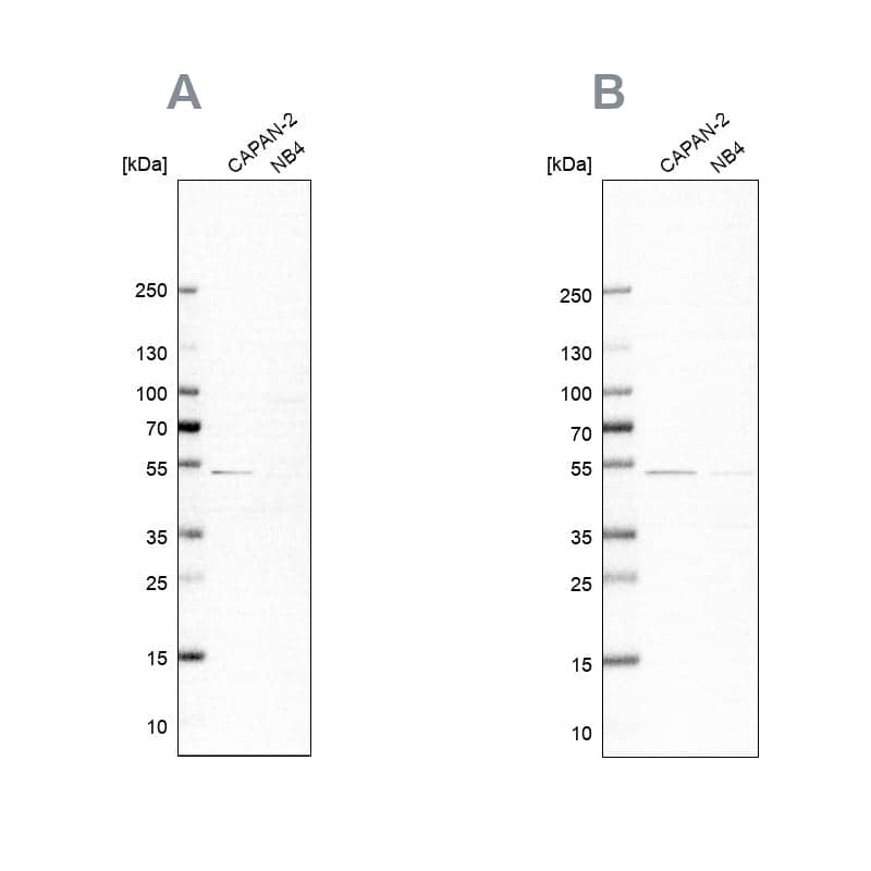 SPTLC1 Antibody Western Blot: SPTLC1 Antibody Antibody [NBP1-81737]