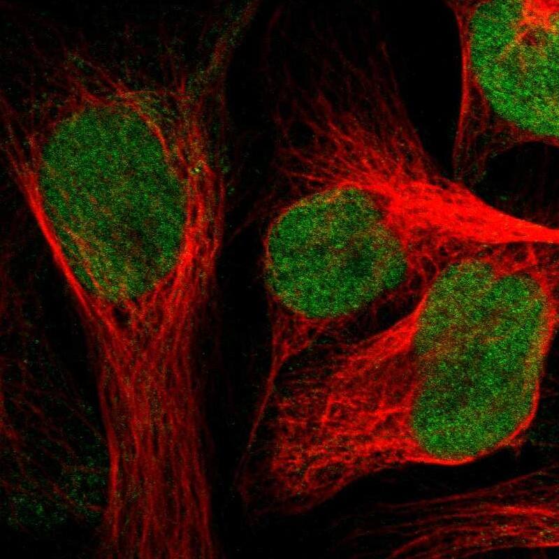 ZNF22 Antibody - BSA Free Immunocytochemistry/ Immunofluorescence: ZNF22 Antibody [NBP1-81739]