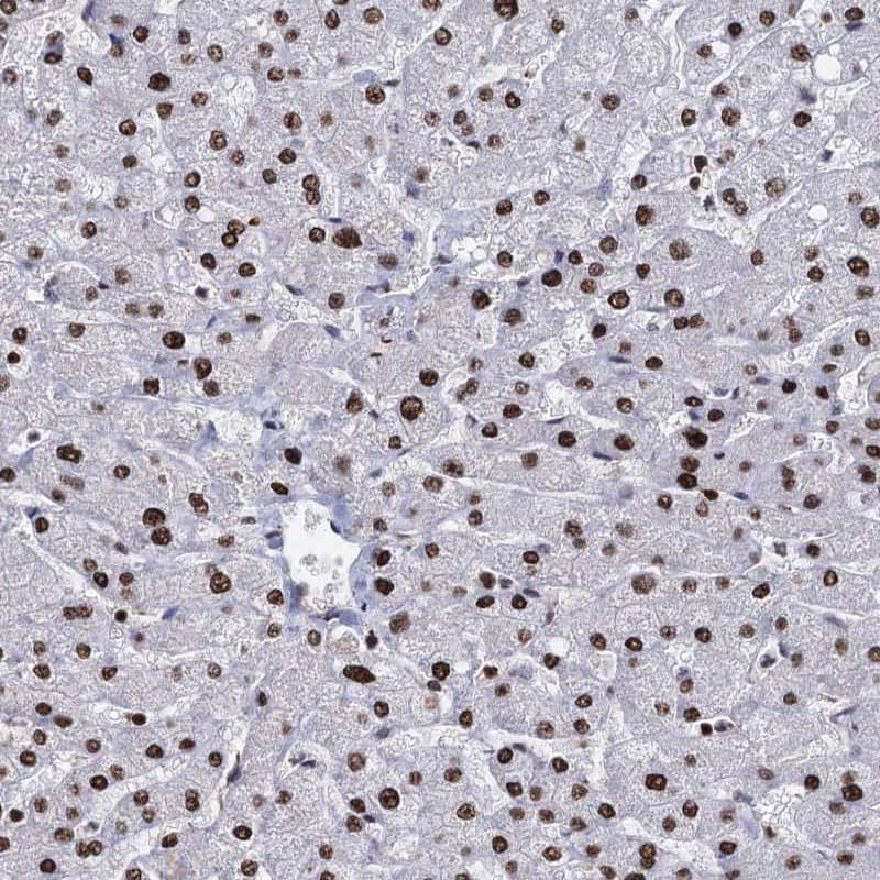 DCPS Antibody - BSA Free Immunohistochemistry-Paraffin: DCPS Antibody [NBP1-81749]