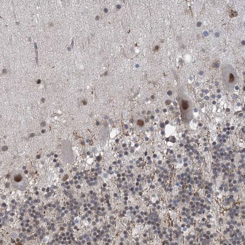 ZNF8 Antibody - BSA Free Immunohistochemistry-Paraffin: ZNF8 Antibody [NBP1-81754]