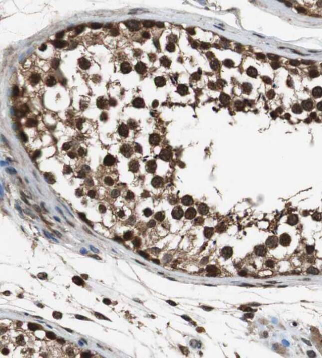 ZNF18 Antibody - BSA Free ZNF18 Antibody [NBP1-81758] -