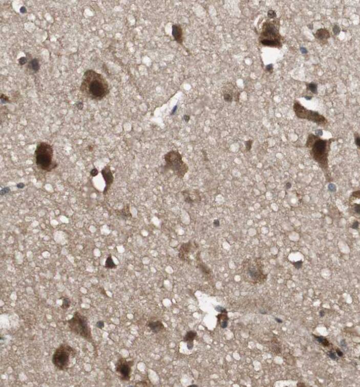 ZNF18 Antibody - BSA Free