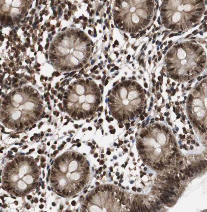 ZNF18 Antibody - BSA Free