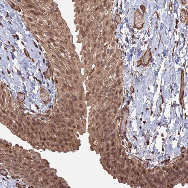 TEL2 Antibody - BSA Free Immunohistochemistry-Paraffin: TEL2 Antibody [NBP1-81761]