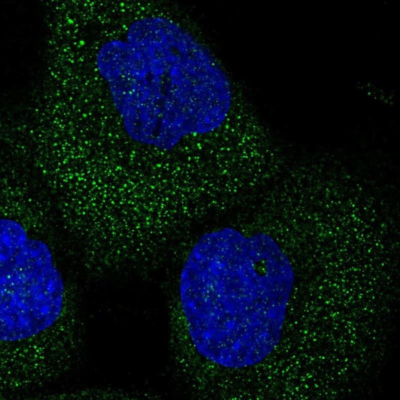 TEL2 Antibody - BSA Free Immunocytochemistry/ Immunofluorescence: TEL2 Antibody [NBP1-81762]
