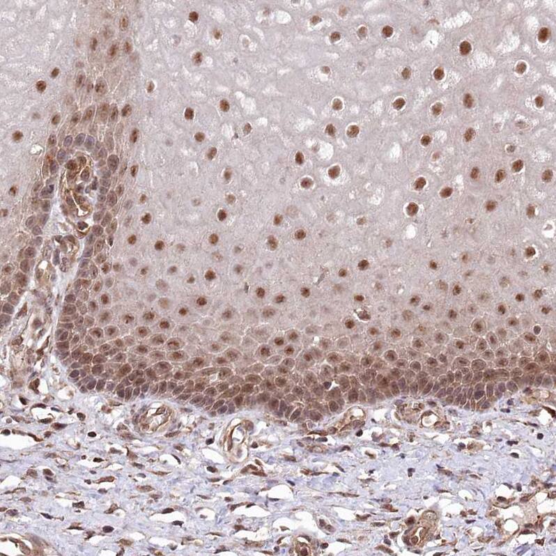 PSMA1 Antibody - BSA Free Immunohistochemistry-Paraffin: PSMA1 Antibody [NBP1-81768]