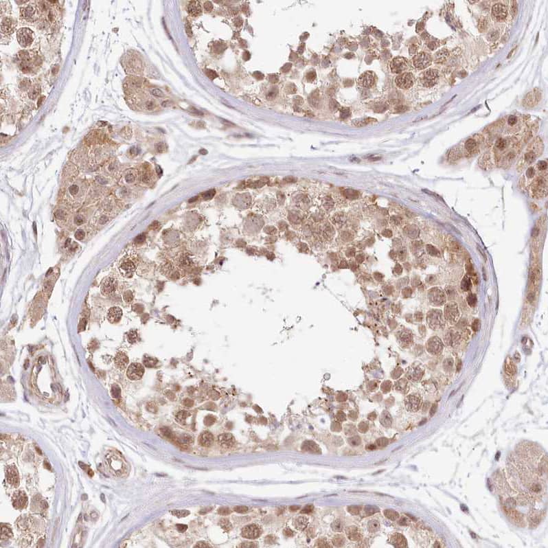 TUBGCP2 Antibody - BSA Free Immunohistochemistry-Paraffin: TUBGCP2 Antibody [NBP1-81841]