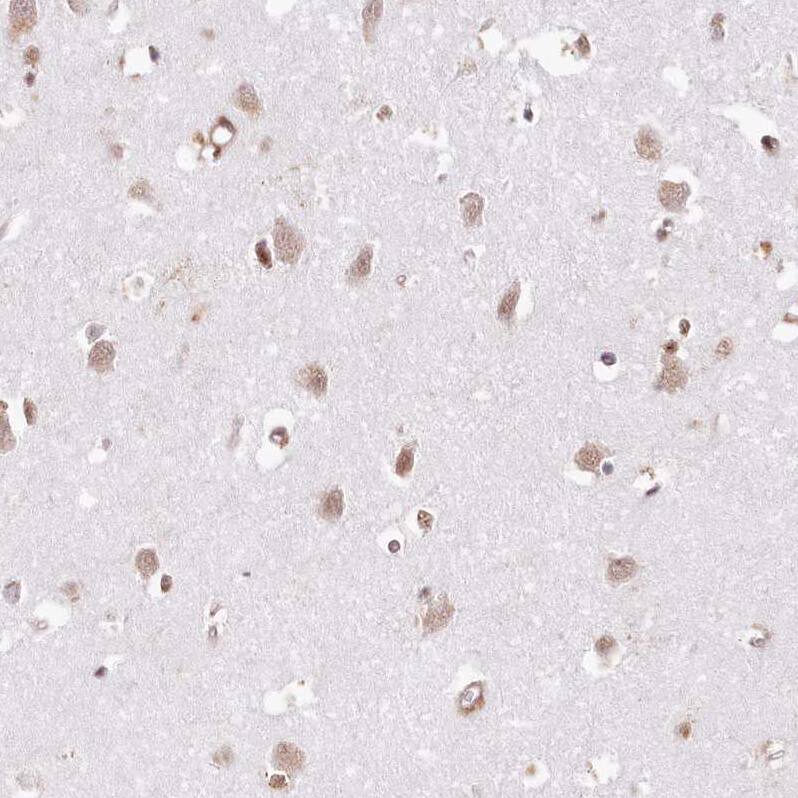 TUBGCP2 Antibody - BSA Free Immunohistochemistry-Paraffin: TUBGCP2 Antibody [NBP1-81841]