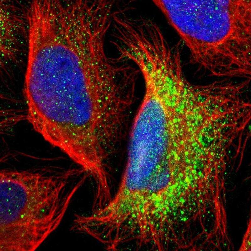 GALNT8 Antibody - BSA Free Immunocytochemistry/ Immunofluorescence: GALNT8 Antibody [NBP1-81848]