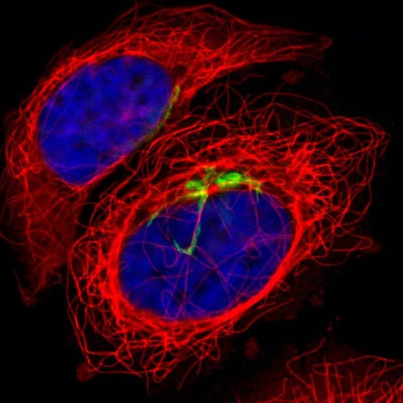 Polypeptide GalNac Transferase 3/GALNT3 Antibody - BSA Free Immunocytochemistry/ Immunofluorescence: Polypeptide GalNac Transferase 3/GALNT3 Antibody [NBP1-81849]