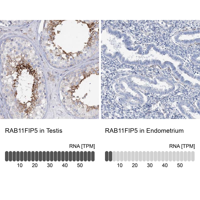 RAB11FIP5 Antibody - BSA Free Immunohistochemistry-Paraffin: RAB11FIP5 Antibody [NBP1-81855]