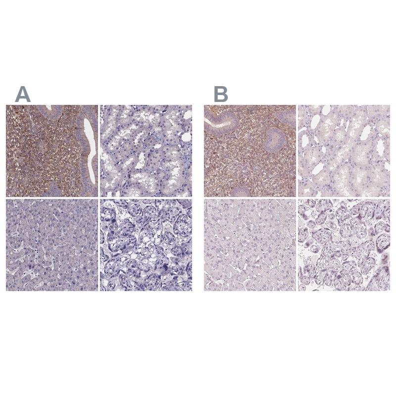 sFRP-4 Antibody Immunohistochemistry-Paraffin: sFRP-4 Antibody Antibody [NBP1-81866]