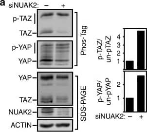 NUAK2 Antibody