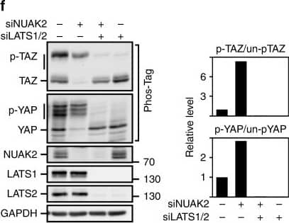 NUAK2 Antibody