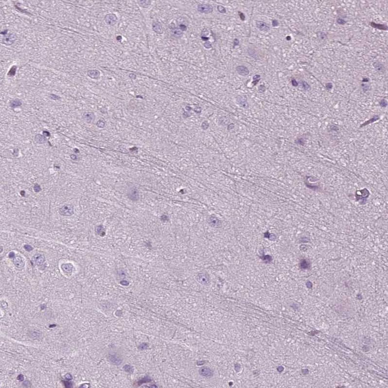 DNAH10 Antibody - BSA Free Immunohistochemistry: DNAH10 Antibody [NBP1-81898]