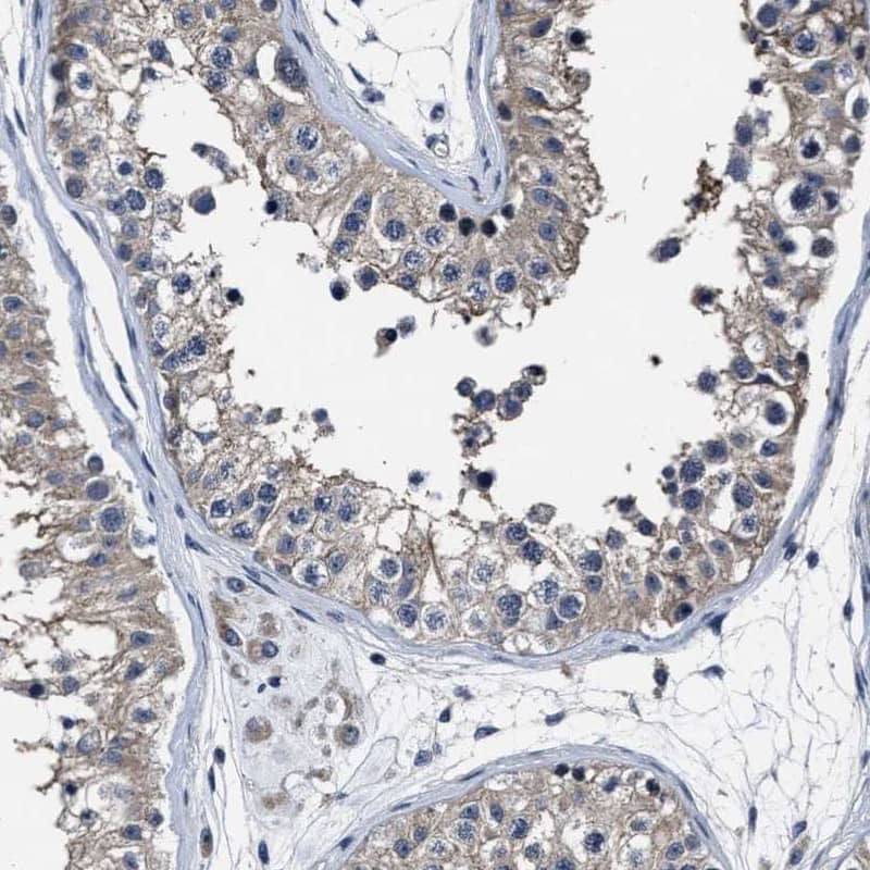 RSBN1L Antibody - BSA Free Immunohistochemistry-Paraffin: RSBN1L Antibody [NBP1-81903]