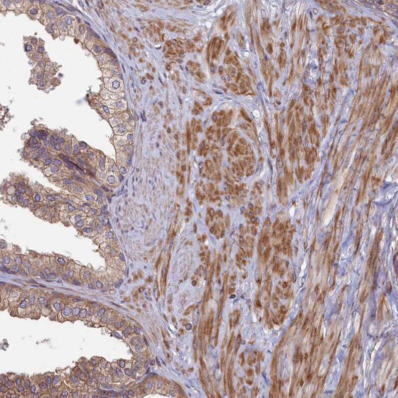 RILPL1 Antibody - BSA Free Immunohistochemistry-Paraffin: RILPL1 Antibody [NBP1-81928]
