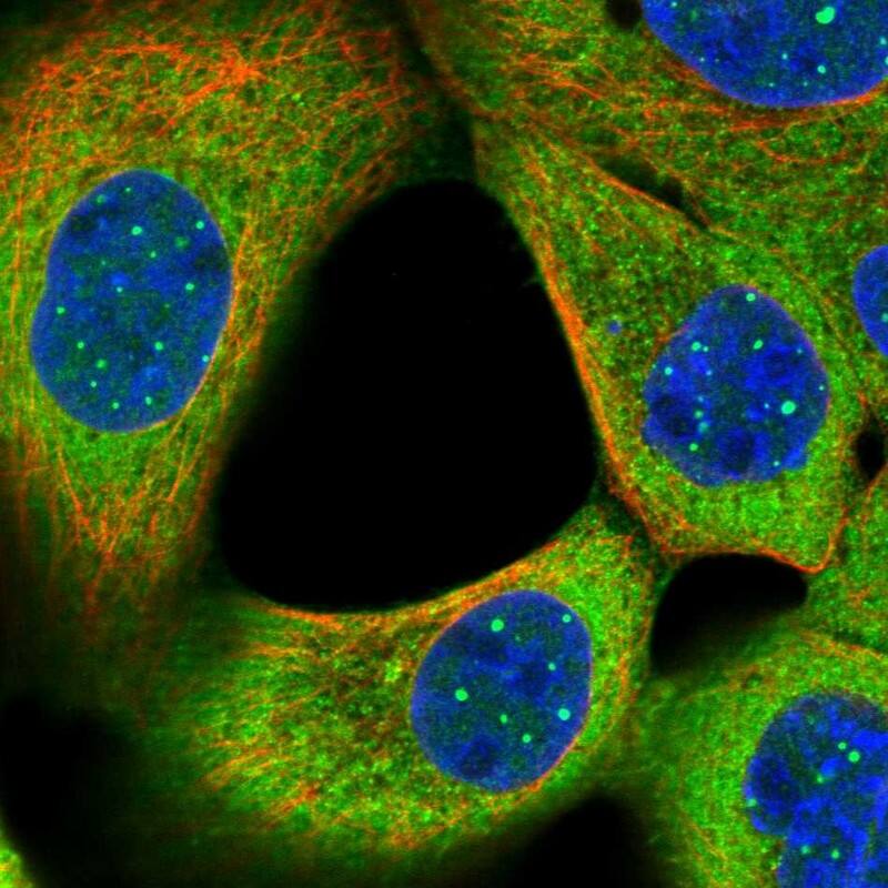 WDR31 Antibody - BSA Free Immunocytochemistry/ Immunofluorescence: WDR31 Antibody [NBP1-81962]