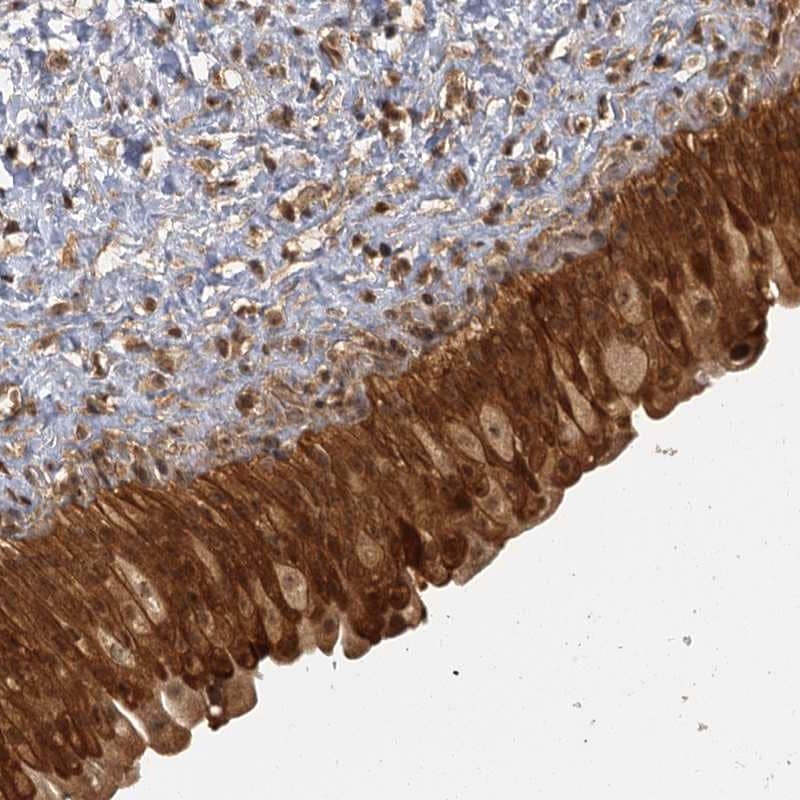 ZNF549 Antibody - BSA Free Immunohistochemistry-Paraffin: ZNF549 Antibody [NBP1-81970]