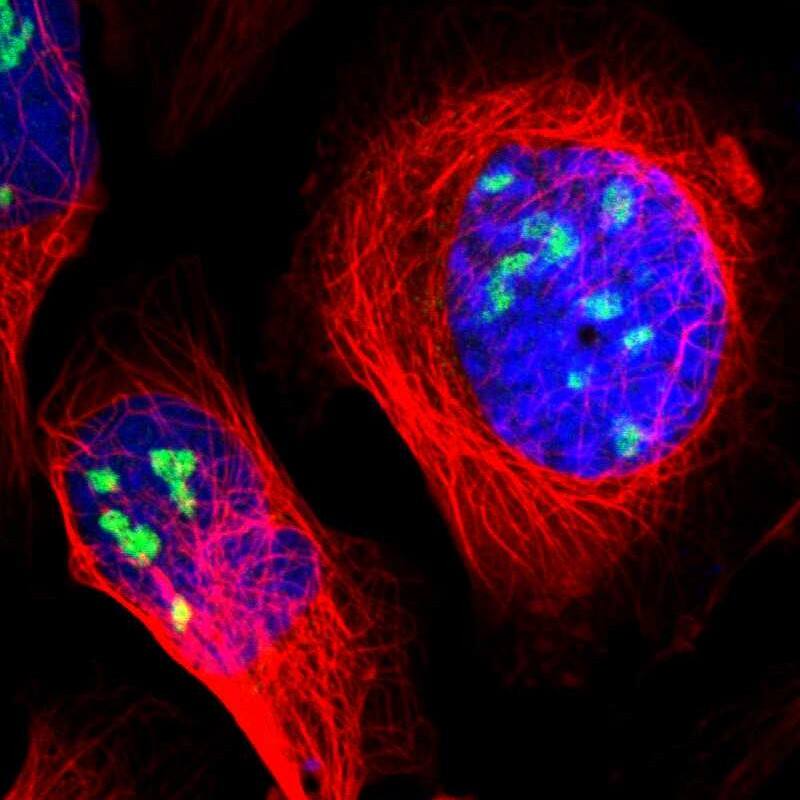 ZSCAN1 Antibody - BSA Free Immunocytochemistry/ Immunofluorescence: ZSCAN1 Antibody [NBP1-81978]