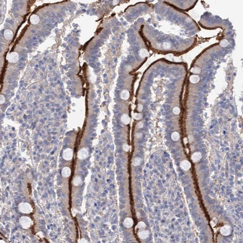 NEK10 Antibody - BSA Free Immunohistochemistry-Paraffin: NEK10 Antibody [NBP1-81991]